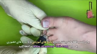 آموزش کاشت ناخن پا : مرحله پنجم : رفع ناهمواری های احتمالی - نیل آکادمی