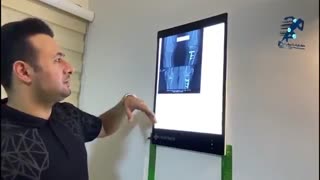 نتیجه تعویض مفصل زانو