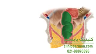 مقعد چیست و ساختار آن چگونه است؟