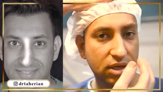 جراحی بینی آقای خواننده مقیم آلمان