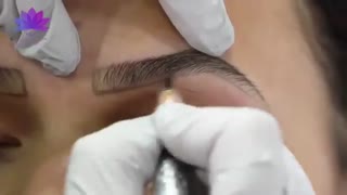 میکرو پیگمنتیشن در کلینیک ارکیده