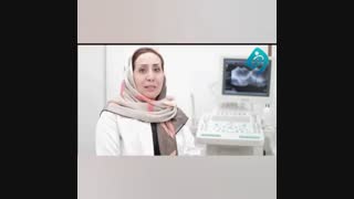 صحبتهای دکتر فاطمه درباره علت تیرگی کشاله ارتودنسی