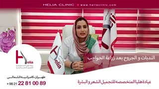 الندبات والجروح بعد زراعة الحواجب | عیادة هلیا | 00989120234708