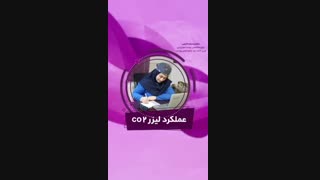 فیلم لیزر CO2