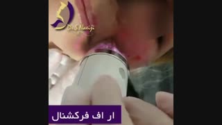 فیلم آر اف فرکشنال