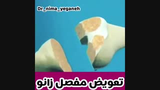 فیلم تعویض مفصل زانو