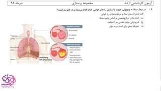 ویدئوی حل تشریحی سوالات کارشناسی ارشد رشته پرستاری درس داخلی جراحی سال ۹۸