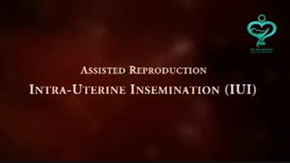 لقاح خارج از رحمی