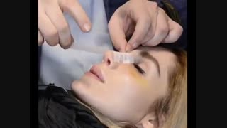 عمل بینی در مشهد | دکتر مهدی رمضانی بهترین جراح بینی مشهد