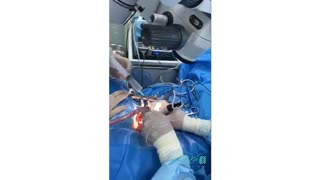 عمل جراحی دیسک گردن