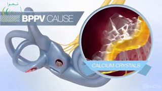 دلایل سرگیجـه  چیست؟آیا سرگیجه میتواند از ناشی از جا به جایی مایع میانی گوش باشد؟
