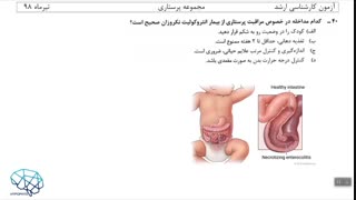 حل تشریحی درس کودکان کارشناسی ارشد پرستاری سال 98