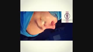 فیلم جراحی بینی فانتزی