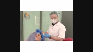 تزریق ژل پروفایلو جهت آبرسانی و جوانسازی صورت