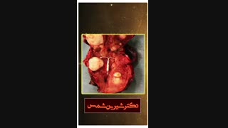 تصویر متفاوتی از رحم