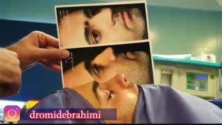 عمل بینی با انحراف شدید توسط دکتر امید ابراهیمی