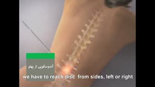 آندوسکوپی از پهلو | متخصص ارتوپد | دکتر محمد ابراهیم طاهریان
