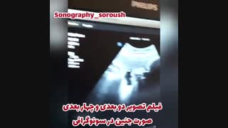 صورت دو بعدی و چهار بعدی