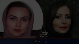 بازیگران زن ایرانی قبل و بعد از عمل جراحی زیبایی