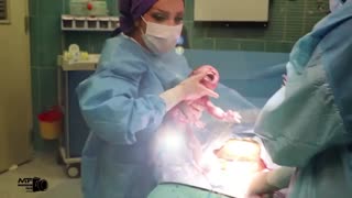 فیلم زایمان سزارین