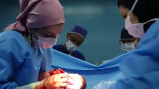 فیلم جراحی سزارین