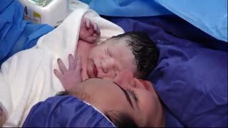 فیلم عمل زایمان سزارین