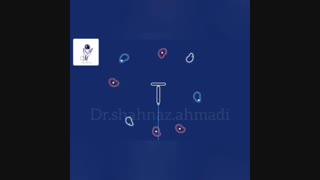روش جلوگیری از بارداری
