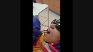 لیزر تراپی بیمار جهت تسریع جوش خوردن ایمپلنت به فک