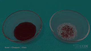 تحلیل استخوان و پیوند استخوان