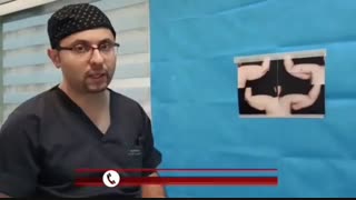 جراحی لیفت بازو