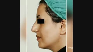 نمونه کار دکتر بخشایی کیا ابرسانی پوست