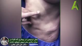 ترمیم لیپوماتیک ناموفق