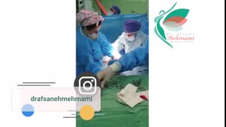 فیلم عمل زایمان سزارین