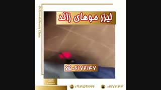فیلم لیزر موهای زائد