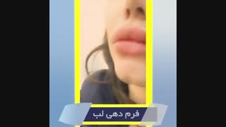 فیلم تزریق ژل لب مدلینگ