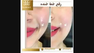 فیلم درمان خط خنده