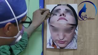 فیلم بسیار جالب از جراحی بینی با شکاف لب