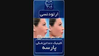 ارتودنسی دندان در کلینیک دندانپزشکی پارسه