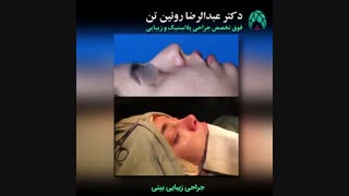 جراحی زیبایی بینی | فوق تخصص جراحی پلاستیک و زیبایی | دکتر عبدالرضا روئین تن