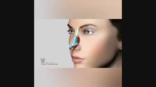نحوه تغییر فرم نوک بینی