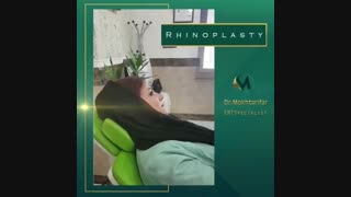 فیلم نتیجه جراحی بینی بعد از دو هفته