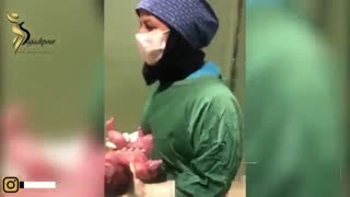 فیلم واقعی زایمان سزارین بیمارستان پارسا