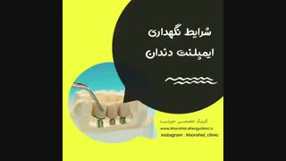شرایط نگهداری ایمپلنت دندان