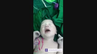 فیلم عمل زایمان سزارین