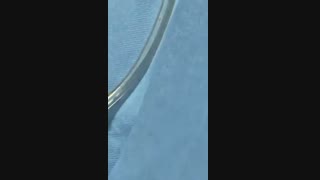 فیلم پیکرتراشی و تزریق چربی با پال کلینیک دندانپزشکی