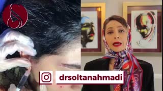 فیلم تزریق پروفایلو