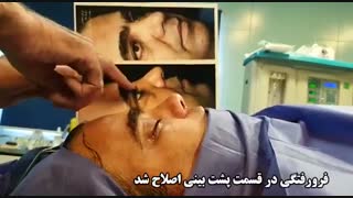 ترمیم بینی گوشتی با استفاده از غضروف گوش	توسط دکتر ابراهیمی