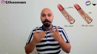 کلسترول - کازئین