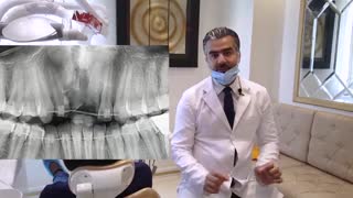 ارتودنسی و جراحی لثه | دکترداودیان جراحی گوش