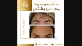 فیلم لیفت صورت با نخ
